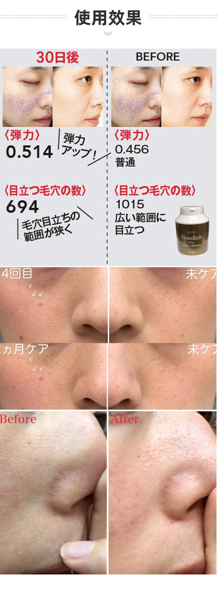 Rizm Noadiah Pro Super Collagen  胶原肽粉  人源水解型 胶原蛋白 30包 金装限定版 HALOHK